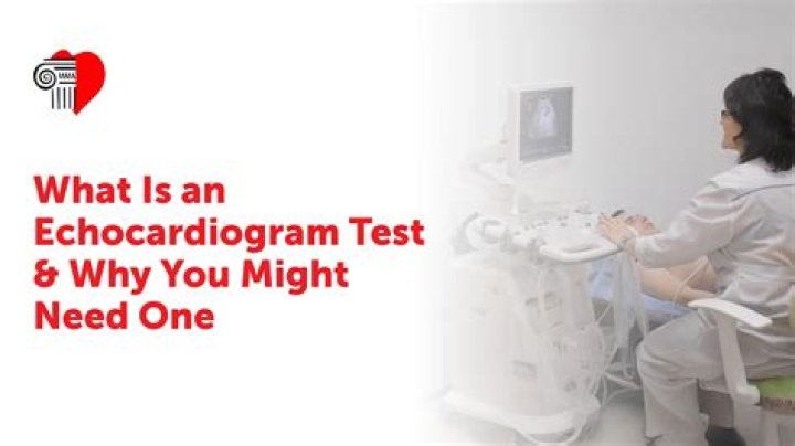 Why is an echocardiogram called an ekg?