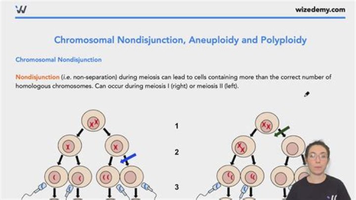 Why is aneuploidy lethal?