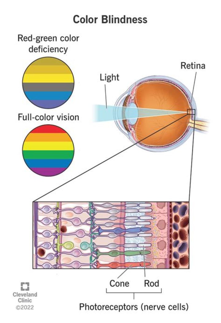 Why is color blindness recessive?