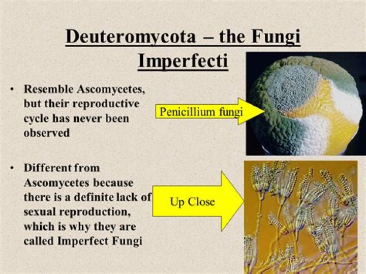 Why is deuteromycetes called fungi imperfecti?
