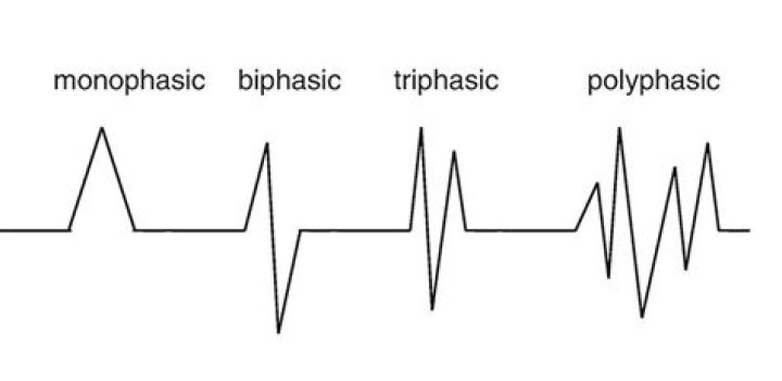 Why is emg waveform irregular?
