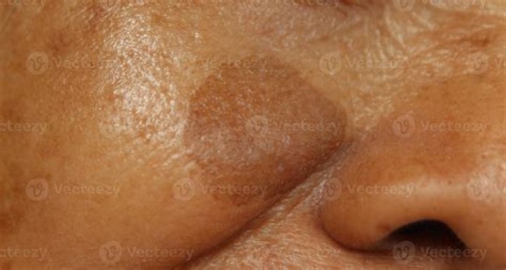 Why is it called brown nosing?