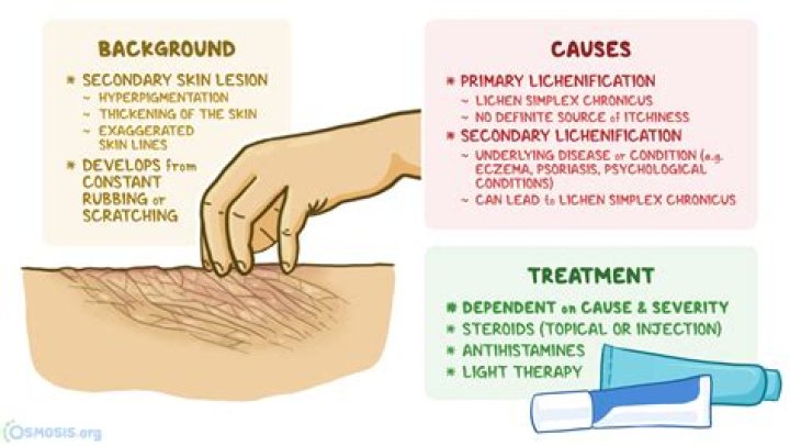 Why is it called lichenification?