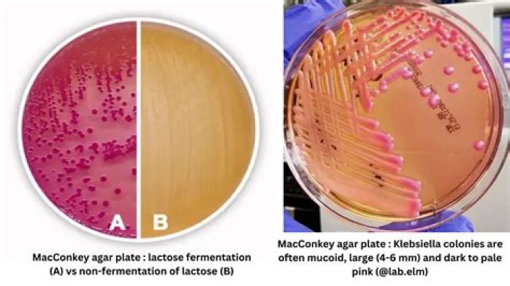 Why is macconkey agar selective as well as differential?