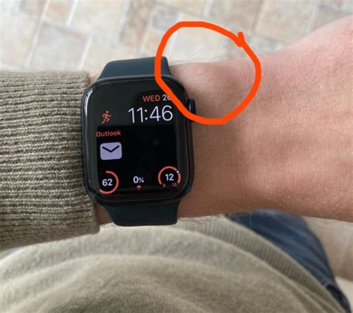 Why is my apple watch making my wrist hurt?