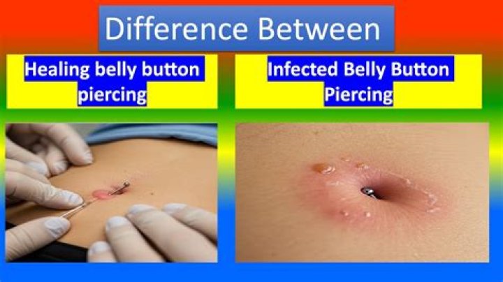 Why is my belly button scabbing?