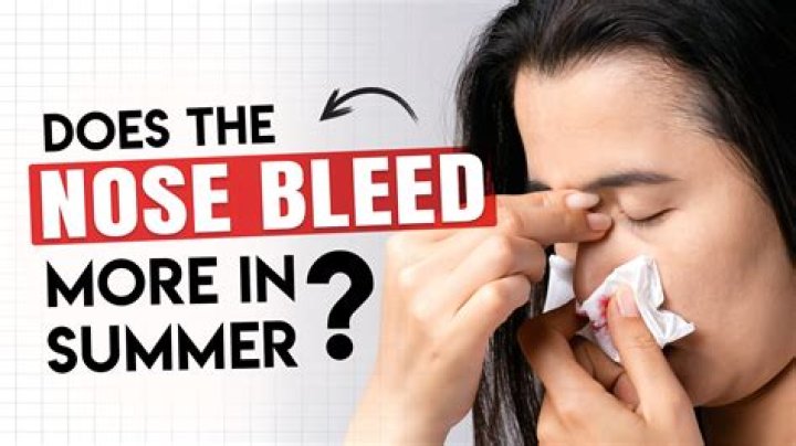 Why is my nose gushing blood?