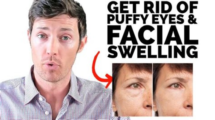Why is one eye always puffier than the other?