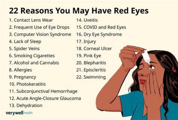 Why is there a layer on my eye?