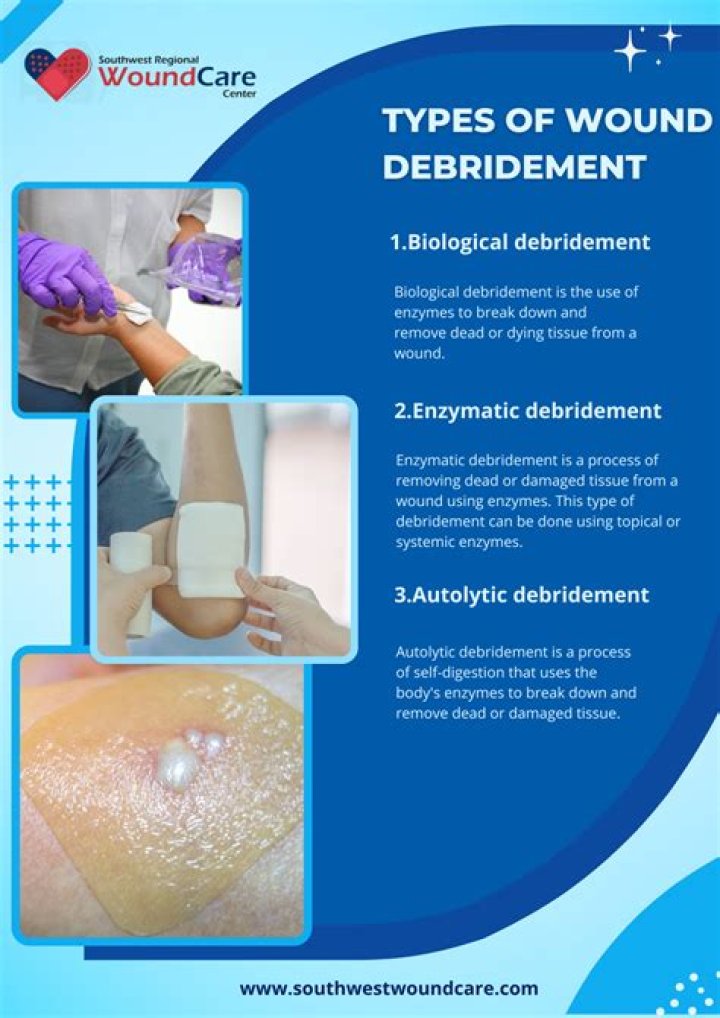 Why is wound debridement necessary?