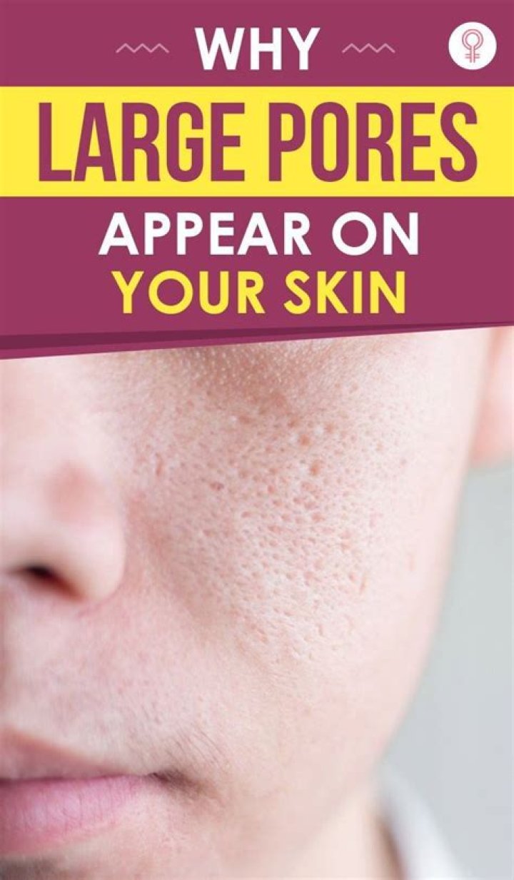 Why my pores are big?