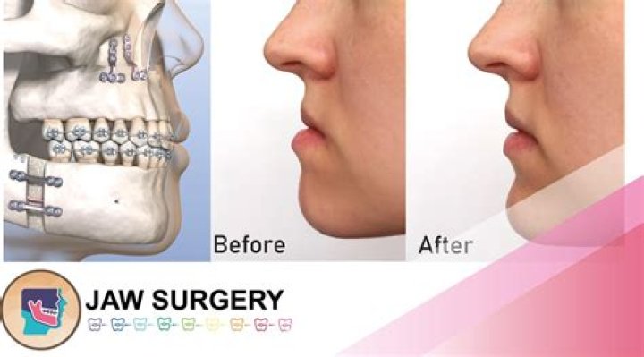 Why reconstructive surgery is used?