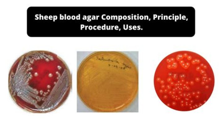 Why sheep blood is used in blood agar?