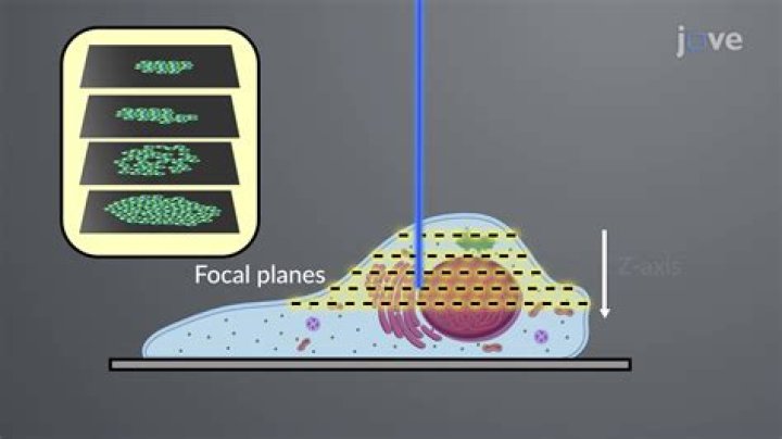 Why stains are used to observe cells?