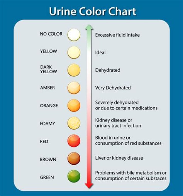 Why urine is dark yellow?