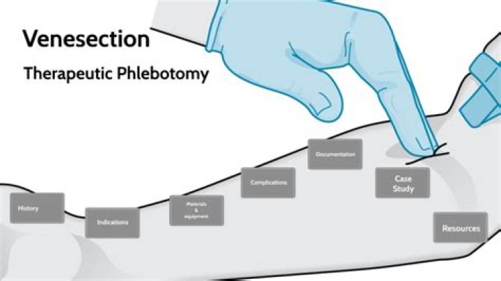 Why venesection is performed?