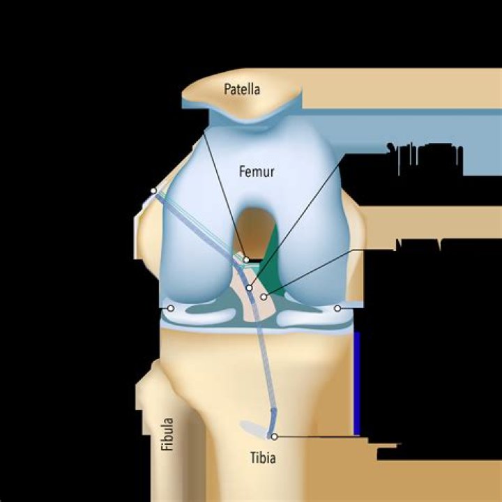 Why won't xref detach?