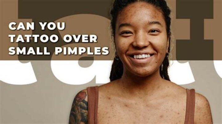 Will a foot peel mess up a tattoo?