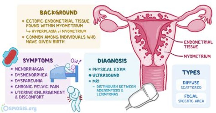 Will adenomyosis affect pregnancy?