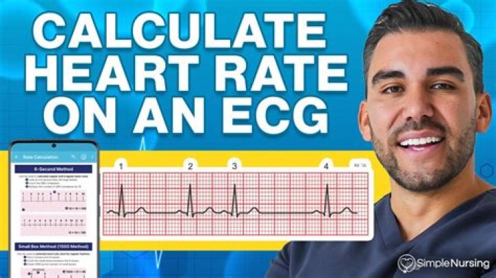 Will an ecg show heart problems?