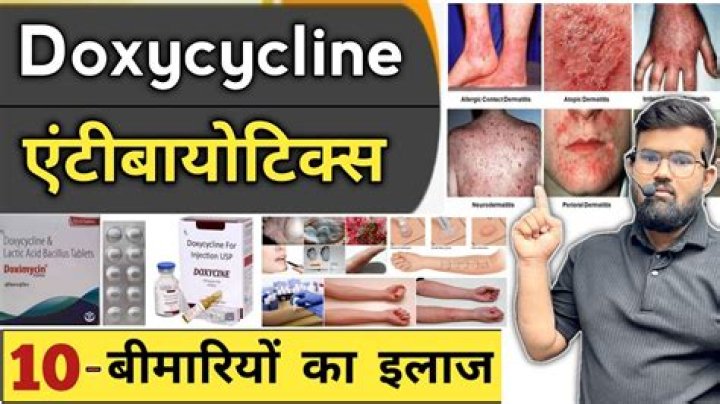 Will doxycycline treat bv?