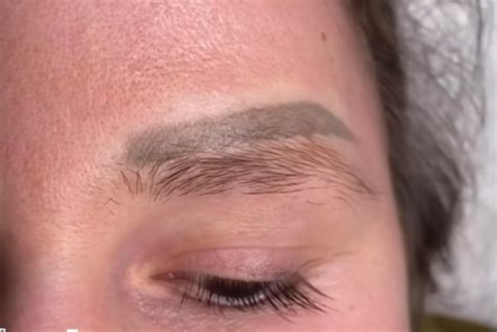 Will hair grow on tattooed skin?
