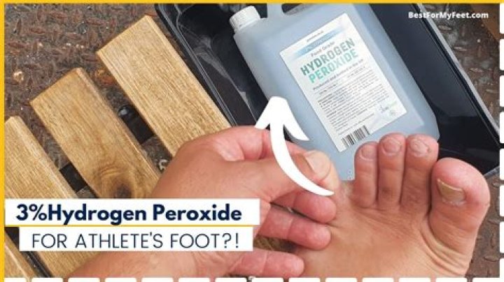 Will hydrogen peroxide kill green algae?