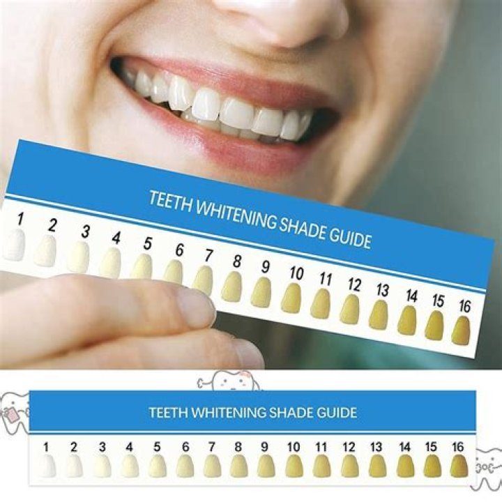Will hygienist make teeth whiter?