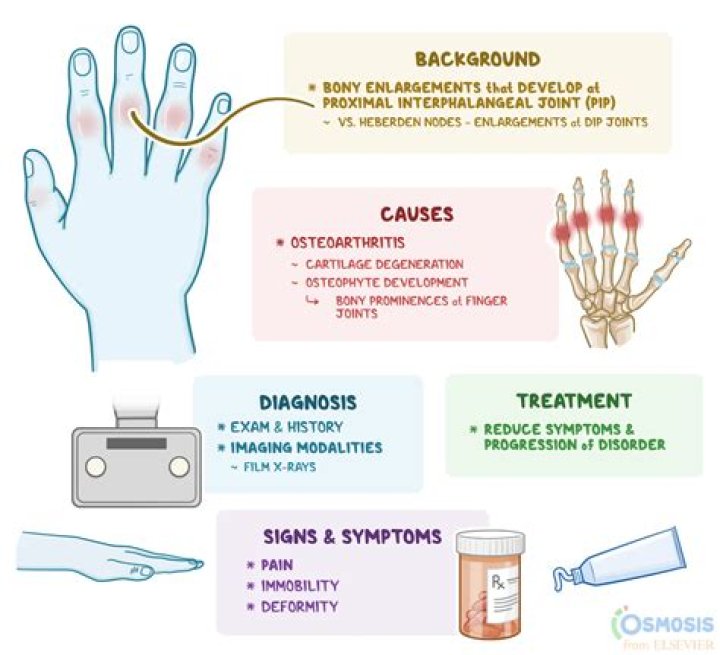 Will rheumatoid arthritis ever be cured?