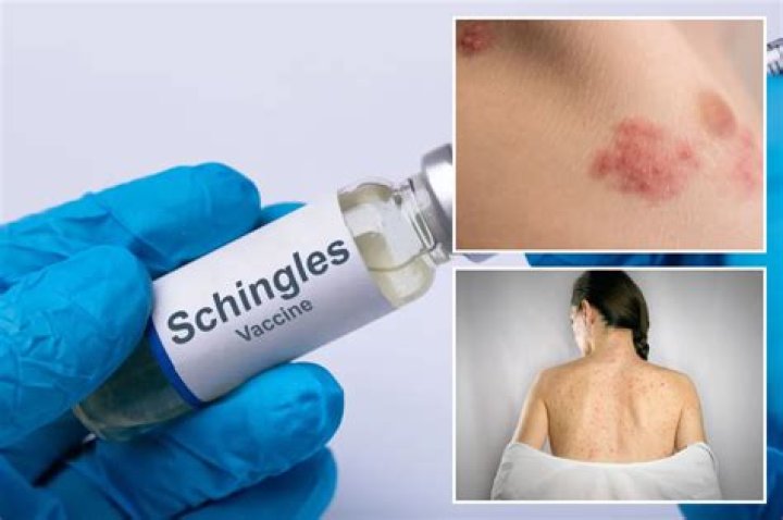 Will shingles vaccine prevent a recurrence?