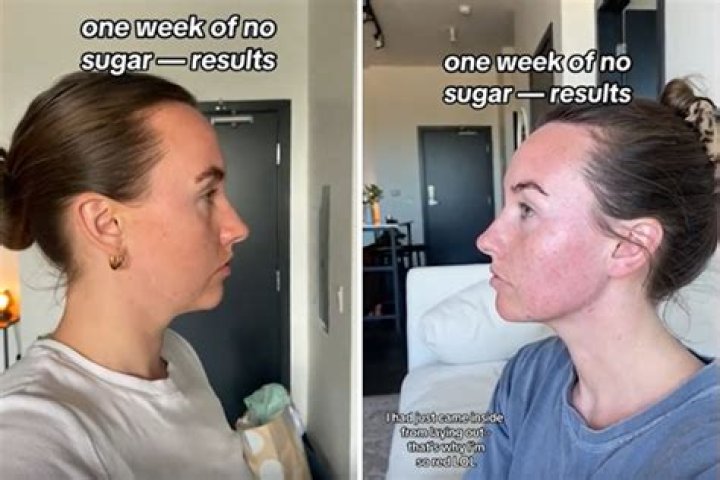 Will sugaring break you out?