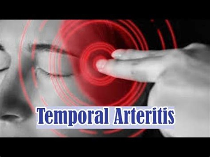 Will temporal arteritis go away?