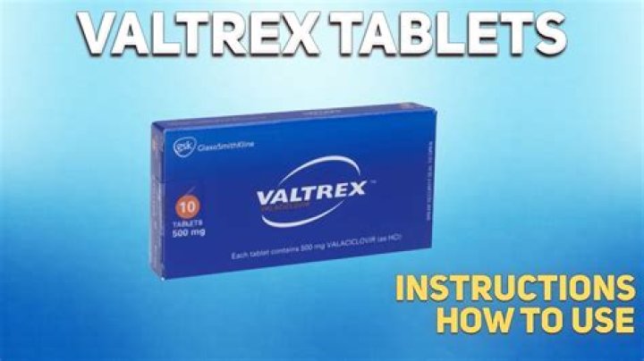 Will valtrex stop a cold sore from forming?