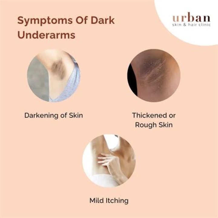 Will veet darken underarms?