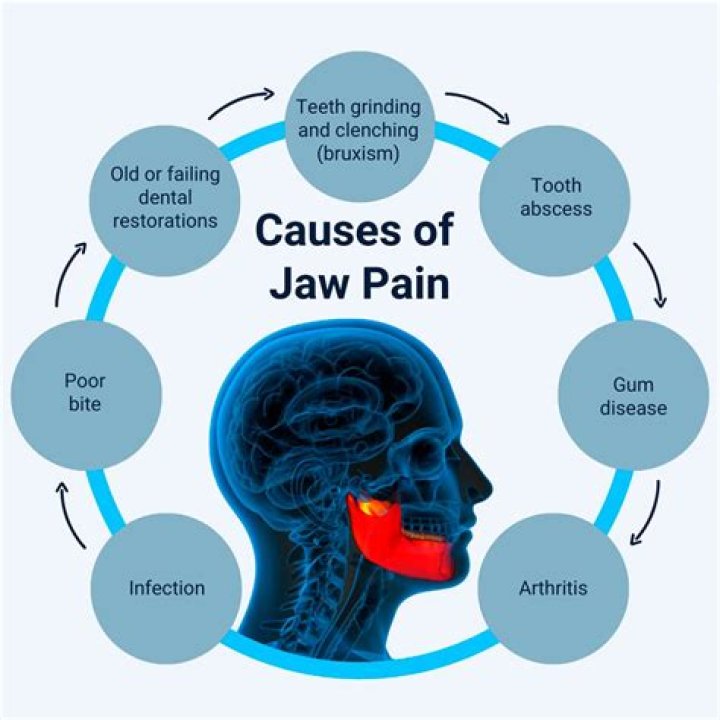 Would a cavity cause jaw pain?