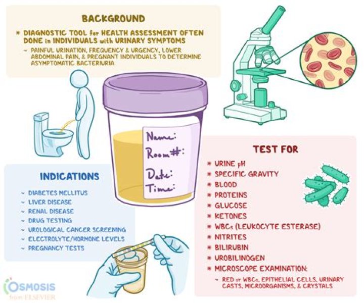 Would diabetes show up in a urine test?