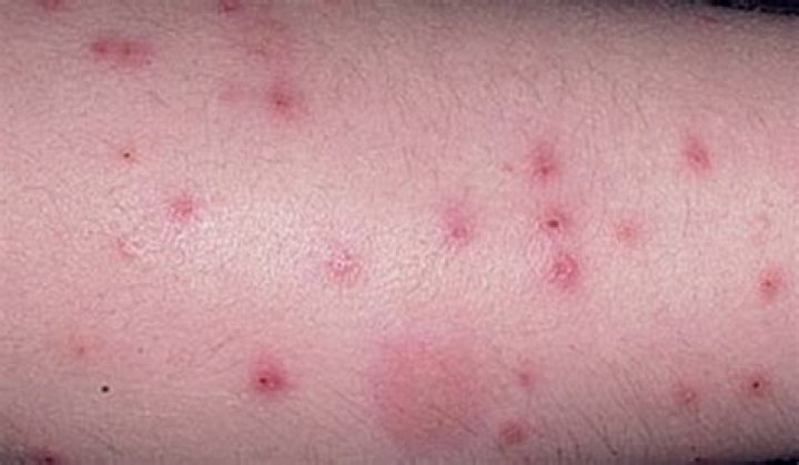 Would fleas bite humans?