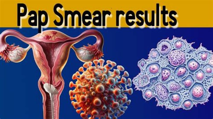 Would pap smear show std?